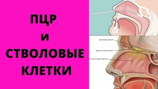 Для чего берут ПЦР тесты? Охота за стволовыми клетками?