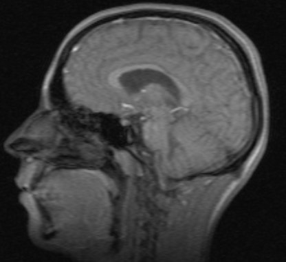 Ильгизар Шарапов | Казань