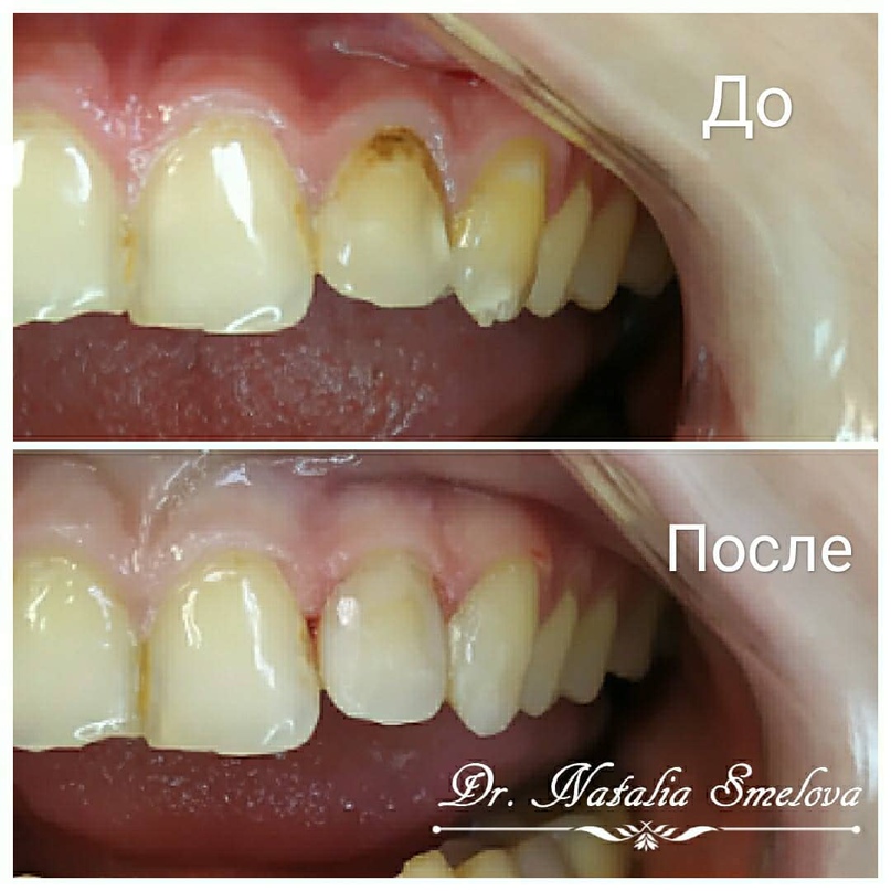 Наталия Смелова | Санкт-Петербург