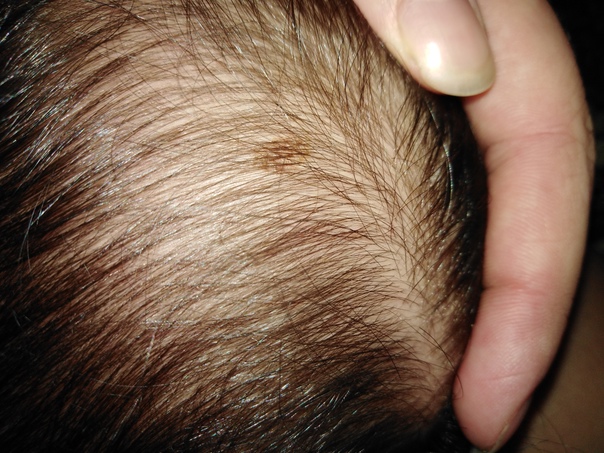 Парикмахер увидела пятно на голове и застыла. Затем она спасла ей жизнь - YouTub